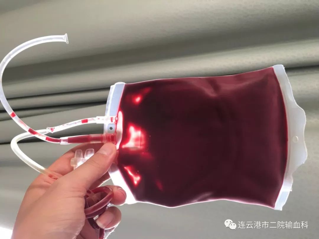 吓坏了的婴儿,b型血和o型血的宝宝会溶血吗