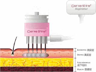 水光针副作用这么可怕,水光针有什么医疗隐患吗
