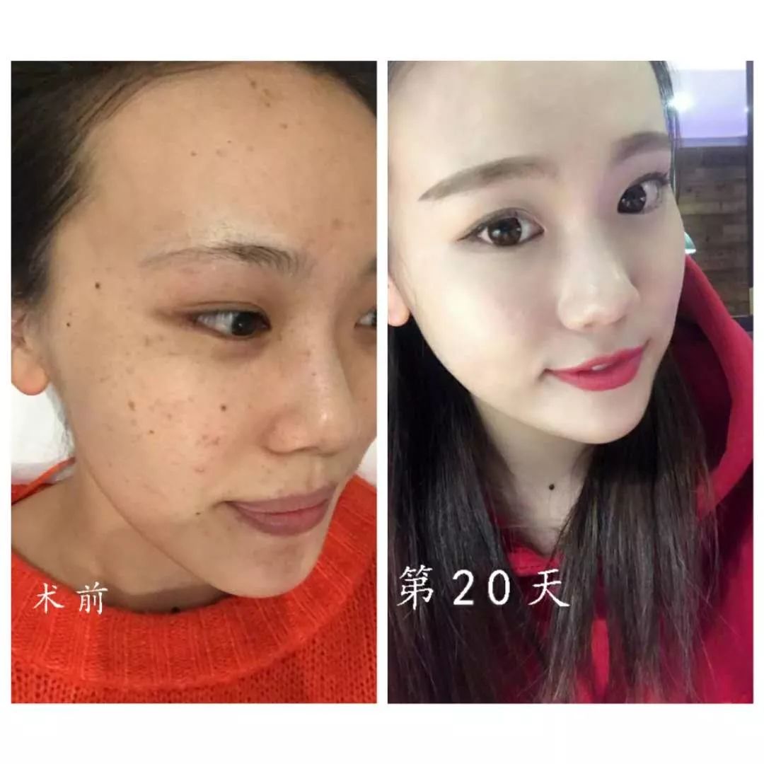 怀孕变丑真正原因,什么时候怀孕变难看