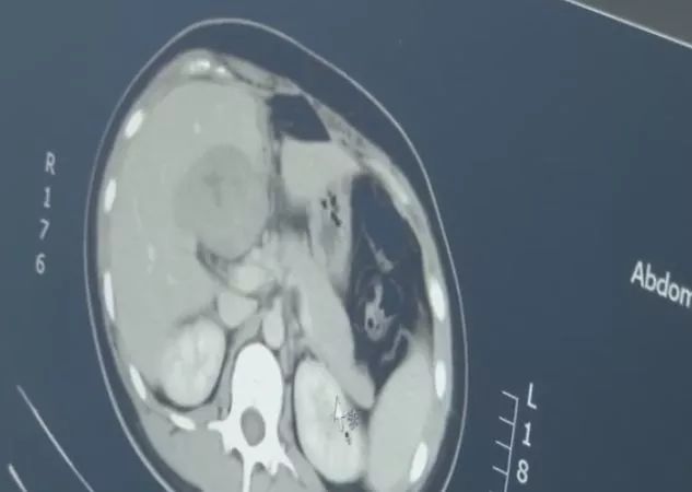 女子怀孕发现自己羊水破了,女子怀孕肚子里却空空如也