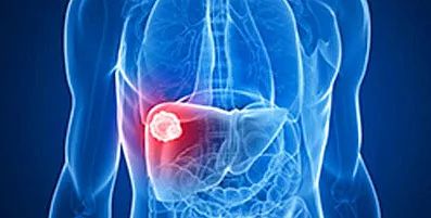 癌症遗传史可以避免吗,没得癌症遗传史会得癌症吗