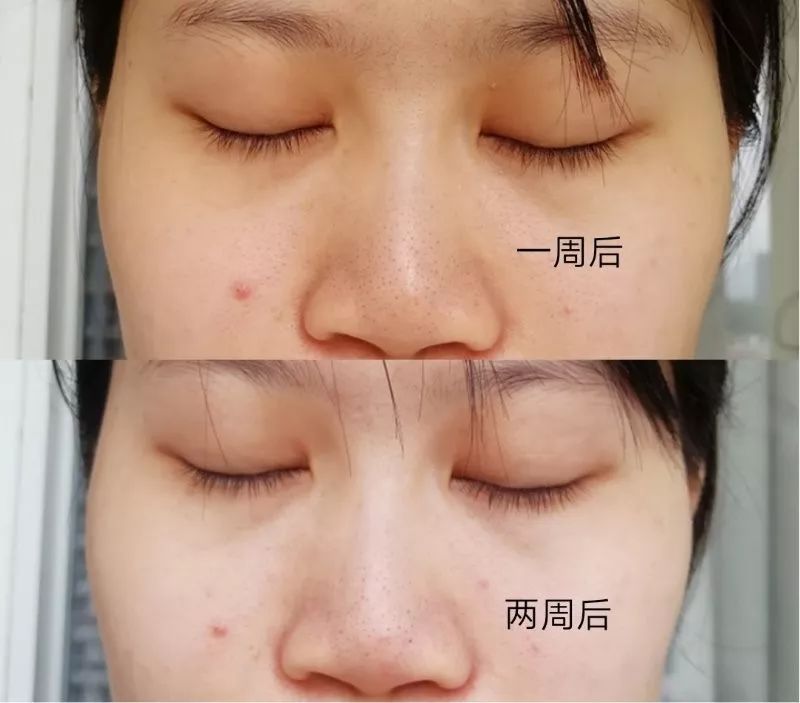 盲测14天揭密|年轻肌特训营收关，那瓶好评如潮的精华水究竟是谁？