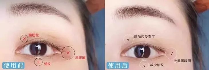 德国变态震动棒，啪啪啪间抚平眼袋、黑眼圈！不用开刀，就能让你年轻十岁！