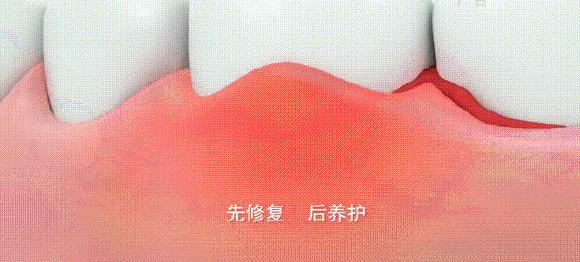 去除黄牙牙垢的牙膏,去口臭黄牙牙垢的牙膏