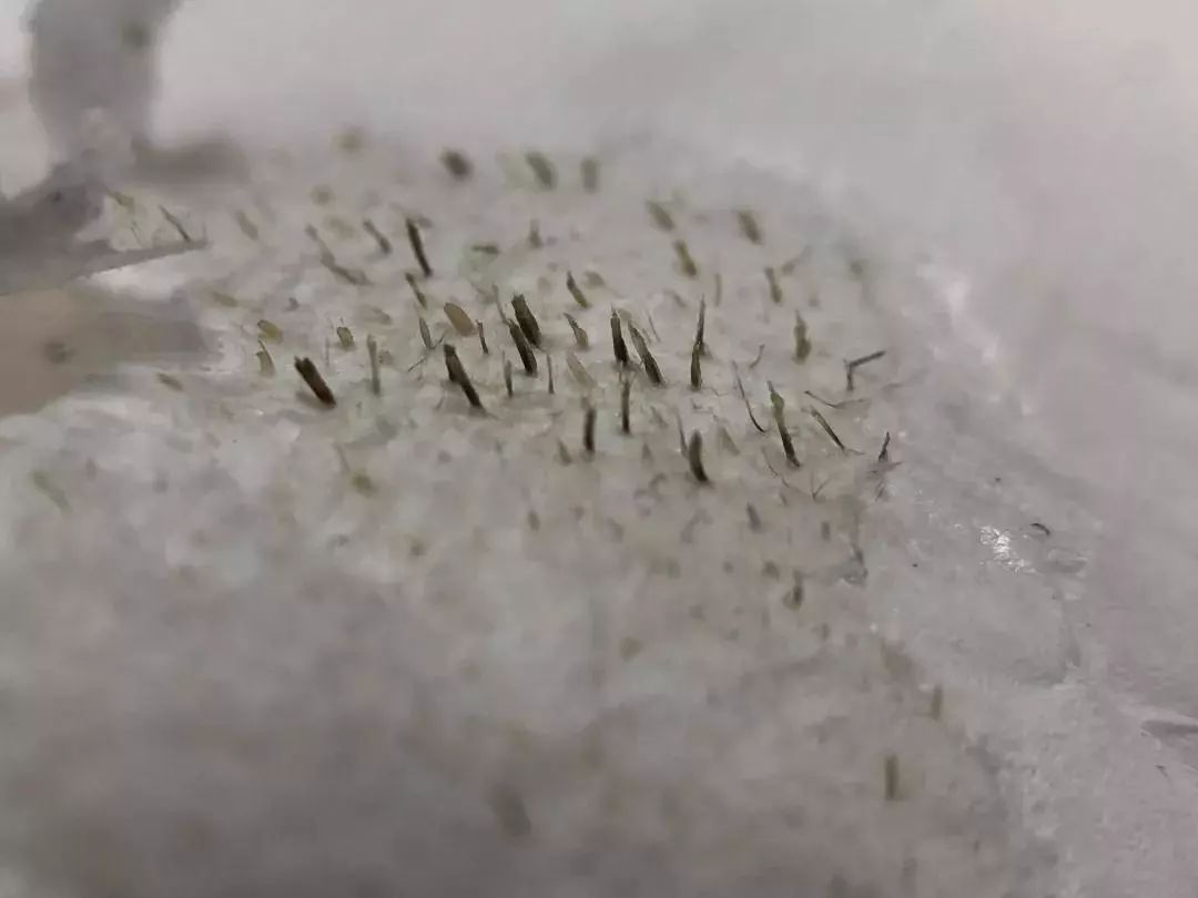 怎么把脸上的黑头清掉,去黑头推荐全脸