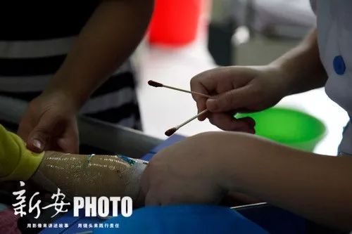 碰一下就会中毒的物质有哪些,被误食的致命毒物