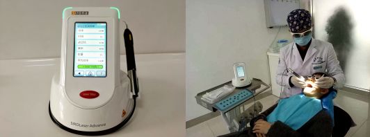 牙颈部龋了个小洞,牙颈部楔状缺损