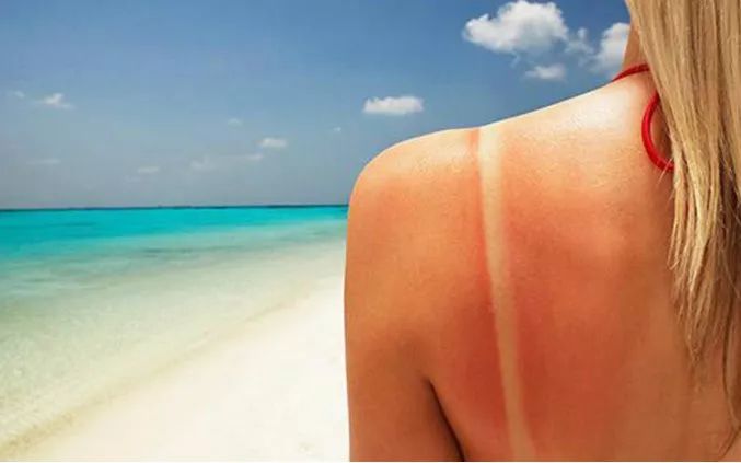 中暑应急处置措施有哪些内容,中暑怎么办这些急救方法了解一下