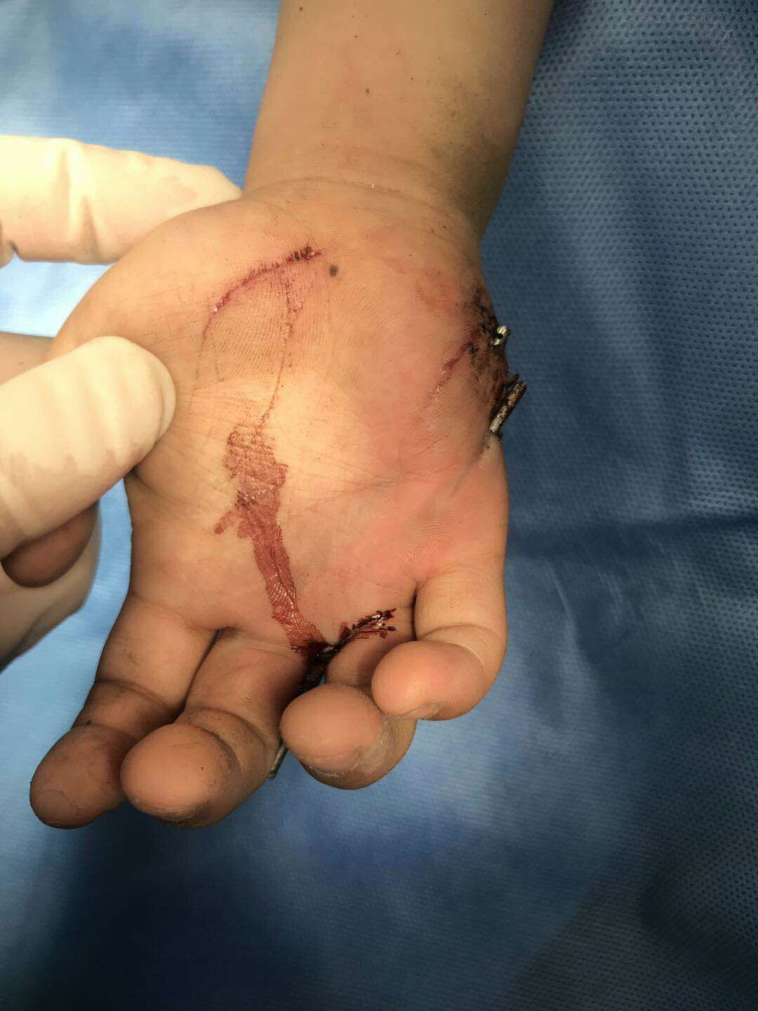 哈尔滨儿童医院骨科怎么样,哈尔滨骨科医院儿童骨科