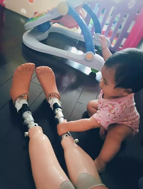 残疾人活得更有尊严,残疾人真的一点出路都没有吗