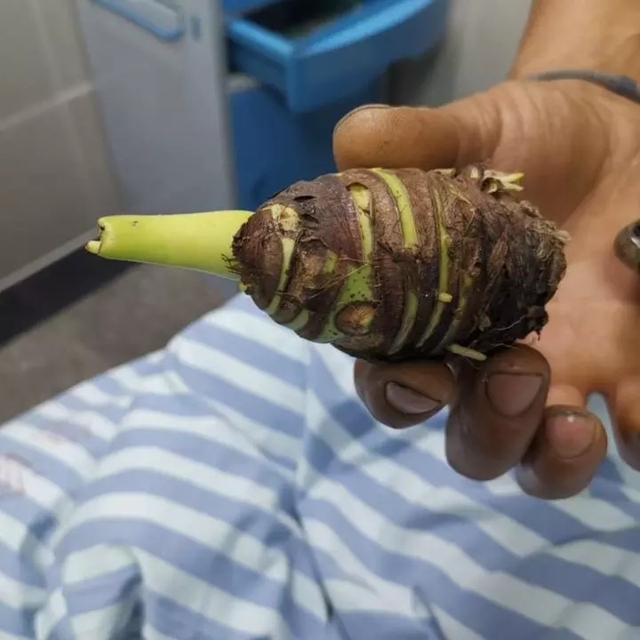 没有煮熟的芋头吃了会中毒吗,吃完芋头千万别碰5种食物