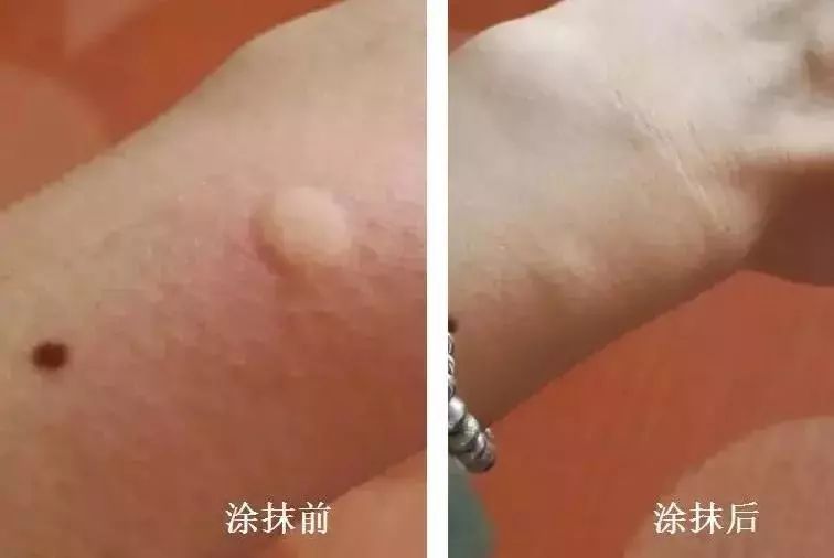 泰国青草膏驱蚊止痒防蚊虫叮咬,泰国蚊子叮咬止痒膏