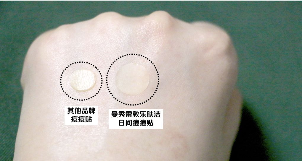 灰头土脸怎么改善,灰头土脸怎么预防