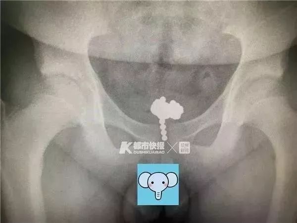 三岁女童身体散发臭味真相,妈妈发现女儿身上有臭味