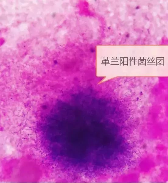 热点丨诡异！男子摸过出土*物文**后反复住院8次，最后发现…