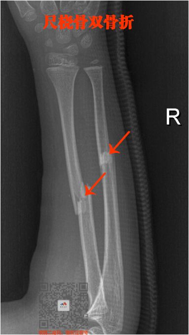 执医技能：X线阅片，全是套路，超简单