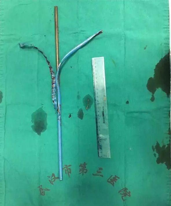 小区外墙瓷砖脱落情况报告,外墙瓷砖脱落居民心惊胆战