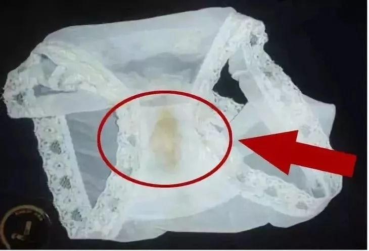 女生不注意下身卫生的危害,不注意个人卫生的表现女生