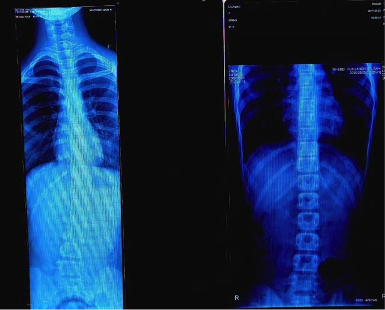 关于小学生体育小知识问答,关于儿童体育运动热点问题