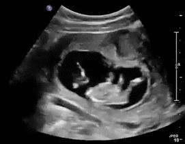 妇产科如何正确指导产妇数胎动,妇产科学讲解