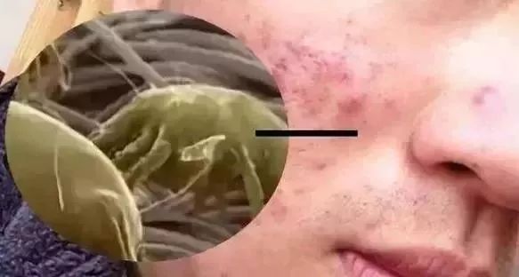 棉花被好还是蚕丝被好,棉花被和棉花被哪个好