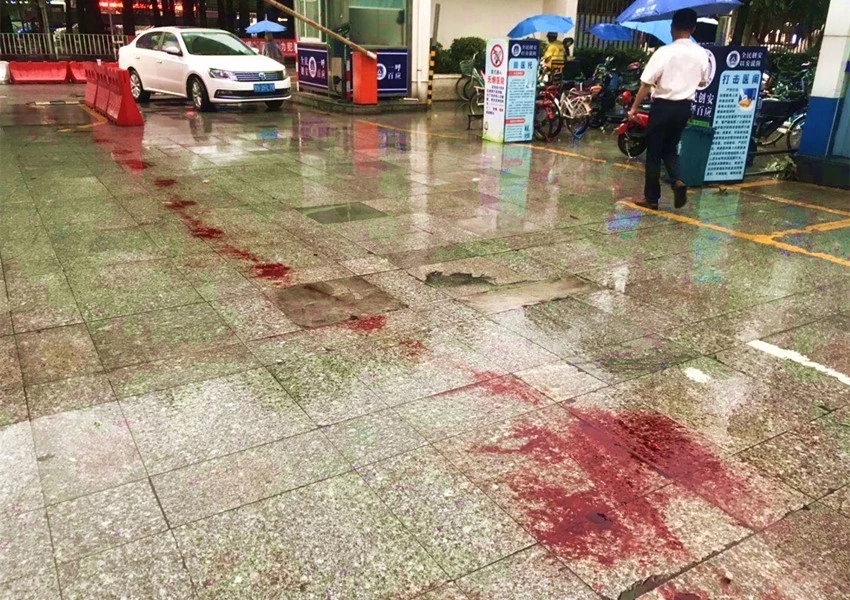 装修工人不小心手出血了,装修工人受伤流血