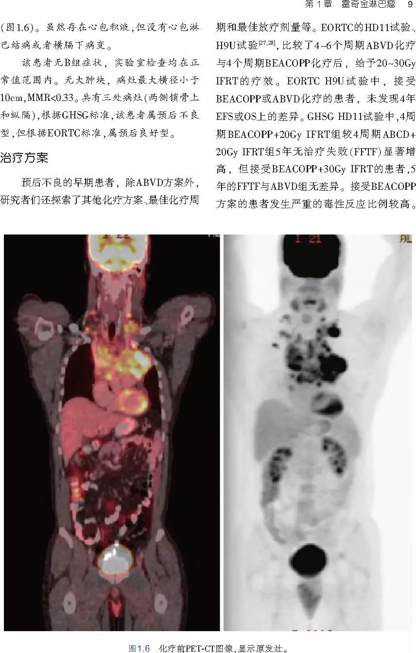 图解血液系统恶性肿瘤放射治疗，如此清晰的指南你见到过吗？