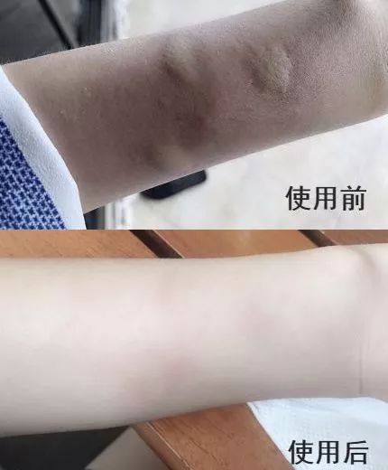 驱蚊止痒神器泰国进口青草膏,泰国防蚊青草膏