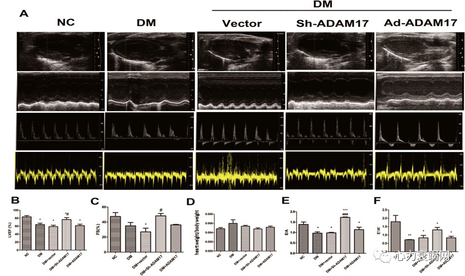 「2019CIHFC」张运教授:ADAM17—糖尿病性心肌病干预的新靶点