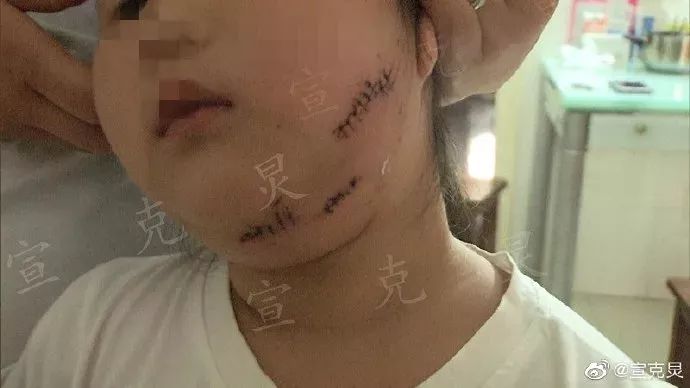 涓婃捣濂冲瓙琚儓鎬х姮鍜激鍚庣画,娌笂骞磋交濂冲瓙琚埍鐘挰鑷村攪鎾曡
