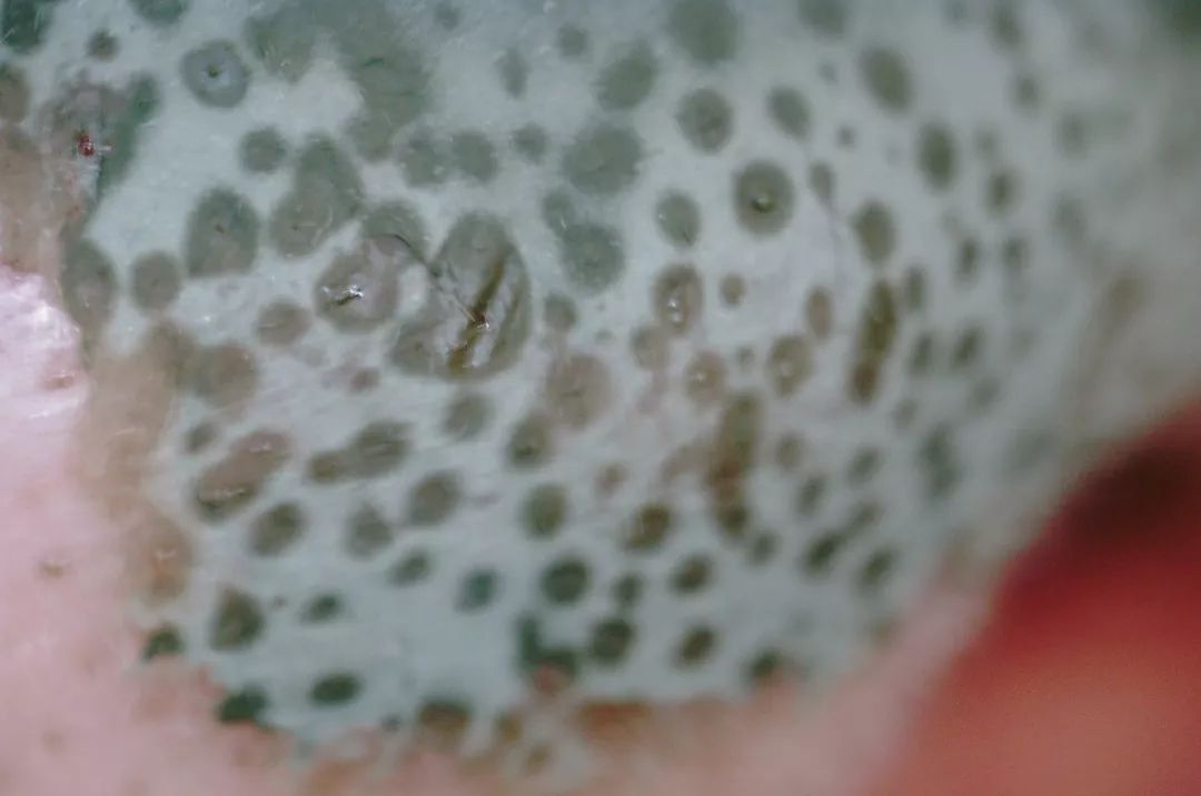 拯救毛孔黑头,清除黑头大毛孔的利器