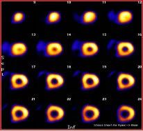 孕妇能接触X线吗？关于怀孕期间的辐射问题，这里是答案|过日子