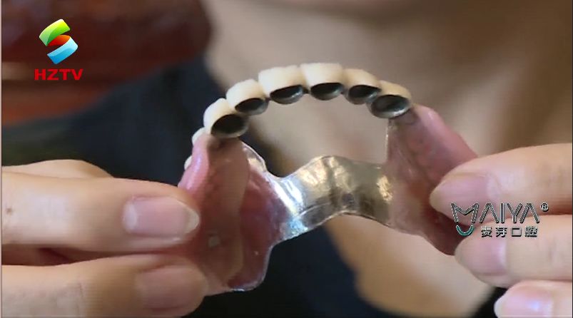 口腔假牙护理,假牙要如何护理不伤害口腔