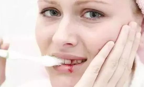 不用打磨牙齿的快速美白方法,不用洗牙能把牙垢黄牙变白的方法