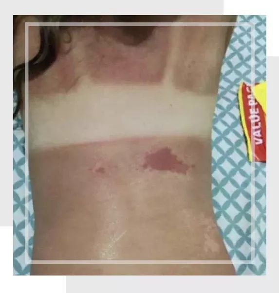 防晒=毁容？宝宝到底应该如何正确防晒？