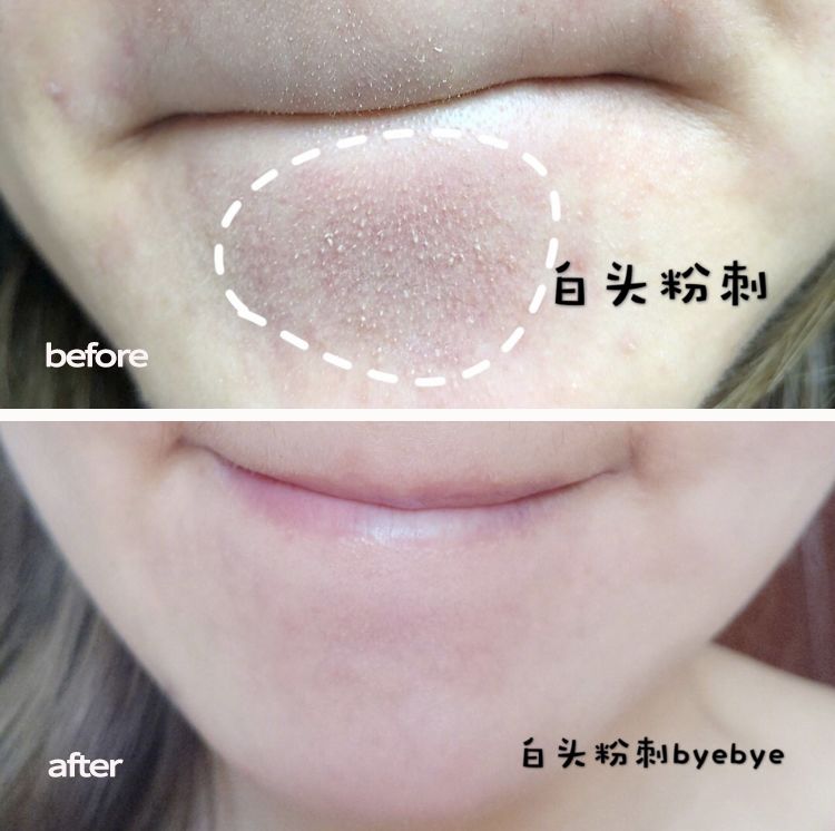 脸上搓出3斤泥！难怪又黄又暗又黑头！10秒给脸蛋“剥壳”，厉害