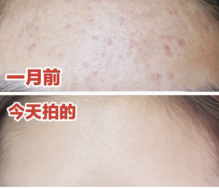 脸上搓出3斤泥！难怪又黄又暗又黑头！10秒给脸蛋“剥壳”，厉害