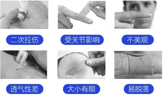 比创可贴好用,最好用的液体创可贴