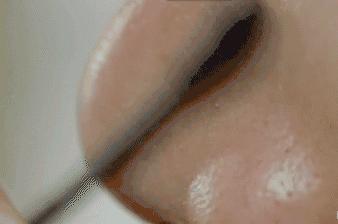 一抹吸出黑头,鸡蛋清除黑头