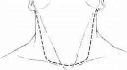 老人身上长肿瘤却被专家误诊后续,脖子长疙瘩医生说是恶性的