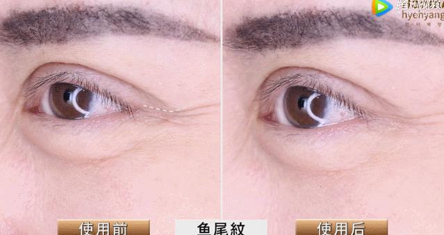 解决皱纹色斑粗糙干燥就用这一套,淡化各种皱纹特别快的好方法