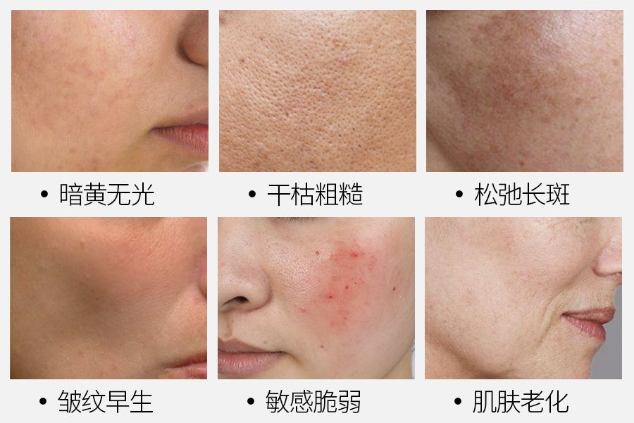 39岁宋慧乔完美复出御姐范十足,37岁宋慧乔重拾颜值巅峰