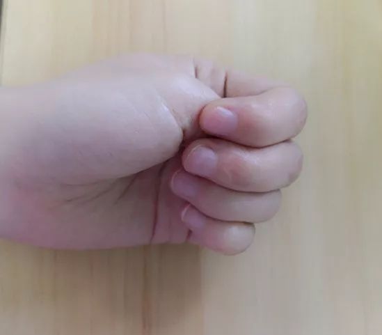 一年四季都有湿气重的表现,夏季三招可以看出体内湿气重不重