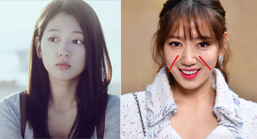 眉间纹和法令纹除皱针能去掉吗,嘴角纹法令纹抬头纹国货推荐