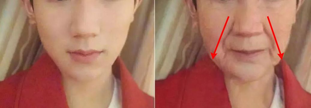 法令纹又黑又长,法令纹又深又长好吗