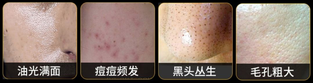 娆ц幈闆呯敺澹礂闈㈠ザ鎺ф补鐐埥娴嬭瘎,娆ц幈闆呮帶娌圭偔鐖芥礂闈㈠ザ鐢峰コ閫氱敤