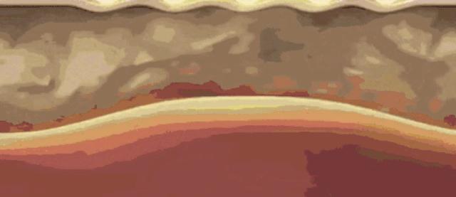 日本4分钟变态减肥法,腿部抽脂大象腿真实案例