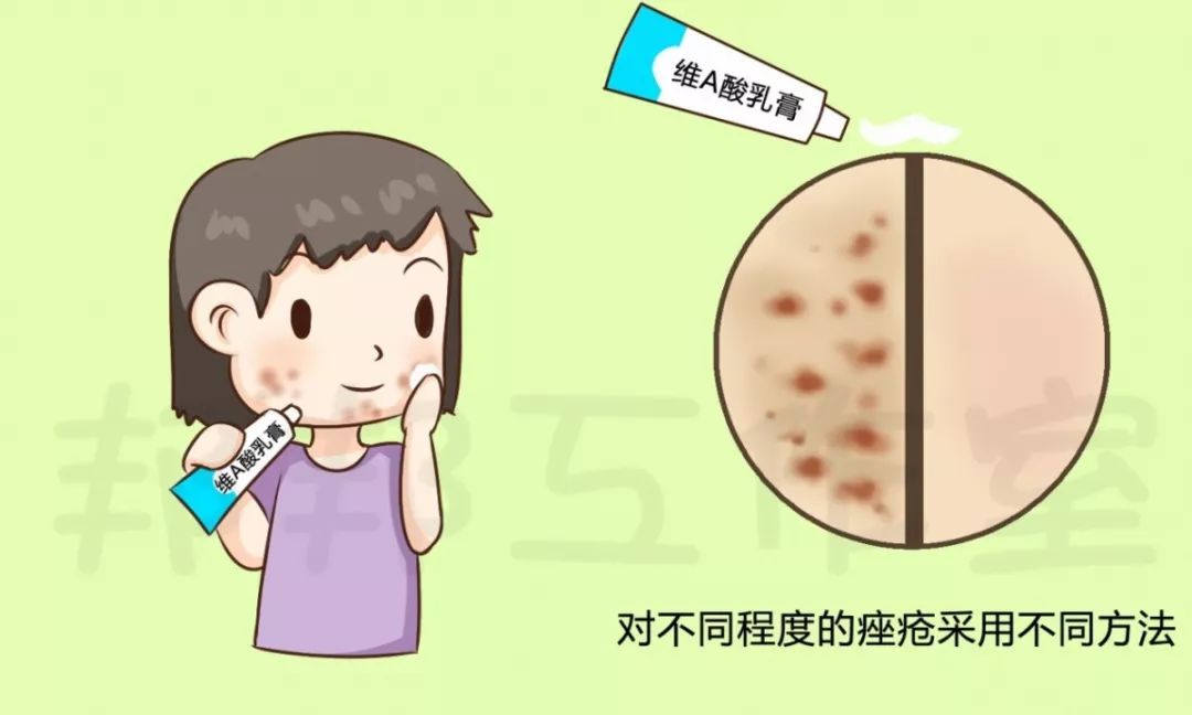 痘痘已经变成硬块了怎么治,痘痘已经形成结节怎么消除