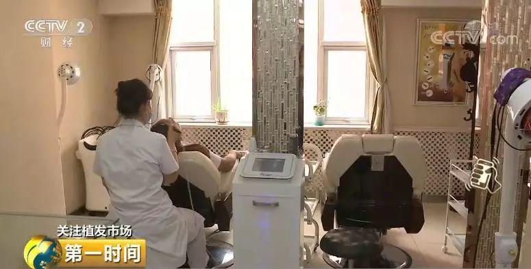 头顶脱发植发有用吗,中国脱发人数2024