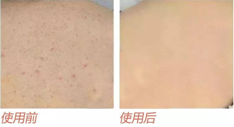 超舒服的洗澡刷,沉浸式泡浴spa团购